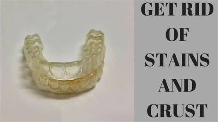 Why does my retainer smell when I take it out?
